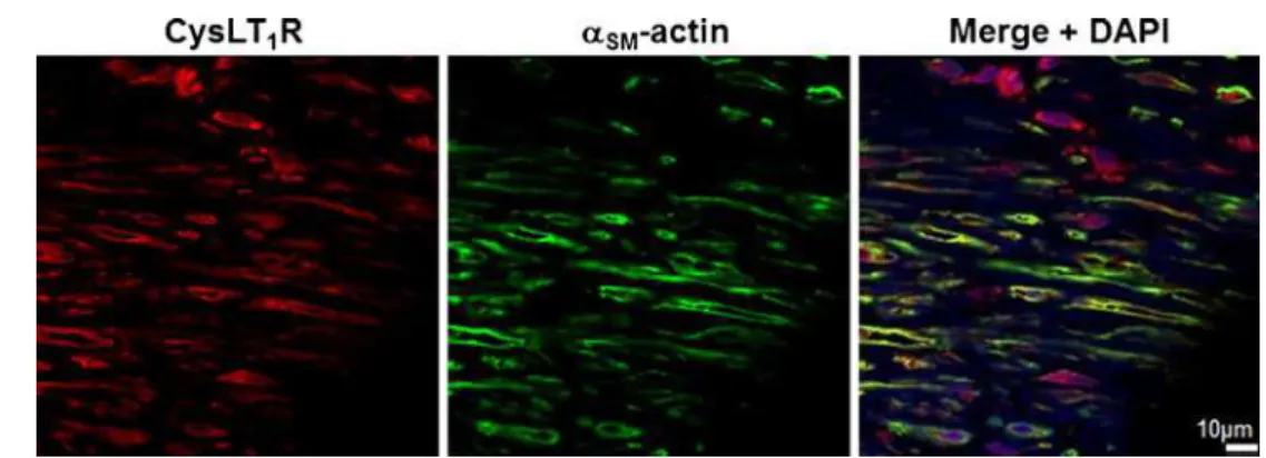 Fig. 2 CysLT 1 receptor expression in human coronary artery smooth muscle cells is upregulated by pro-inflammatory stimuli