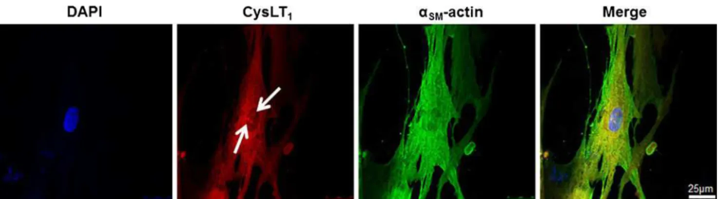 Fig. 4 LTC 4 -induced calcium signaling in human coronary artery SMC. a Representative micrographs of Ca 2+