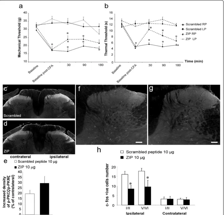 Figure 8 Effect of spinal PKCζ/PKMζ inhibition on pain-related behaviors, PKCζ/PKMζ phosphorylation and Fos expression in spinal neurons following intraplantar CFA