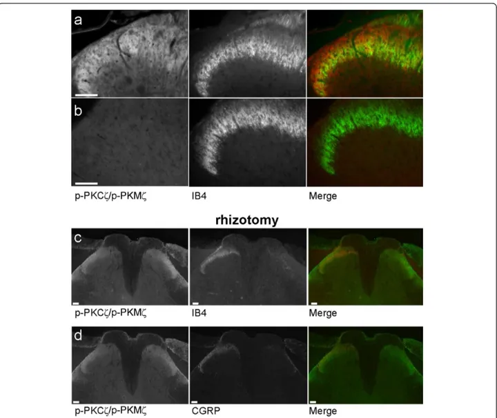 Figure 4 Expression of phospho-PKCζ/PKMζ following lumbar rhizotomy. High power magnification of p-PKCζ/p-PKMζ expression with IB4 in spinal cord sections from formalin rats (a)