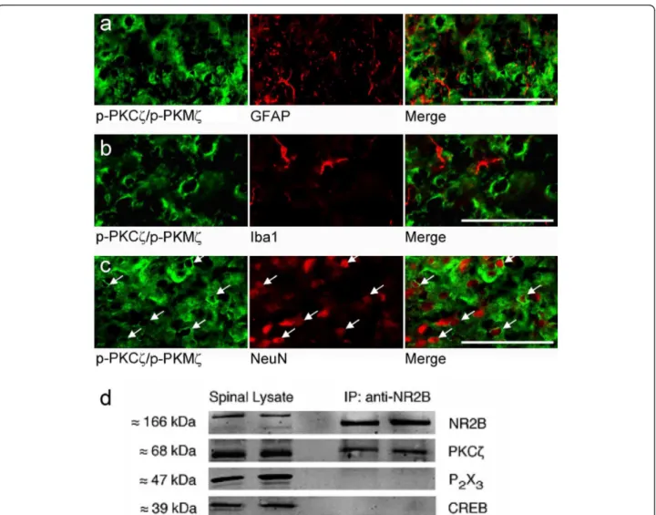 Figure 5 Phospho-PKCζ/PKMζ is expressed in spinal dorsal horn neurons. (a-c) p-PKCζ/p-PKMζ did not co-localize with (a) GFAP or (b) Ib1a but did co-localize with (c) NeuN