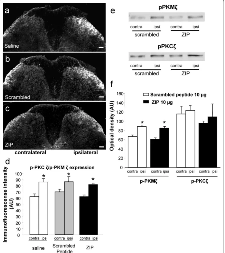 Figure 6 Effect of spinal PKCζ/PKMζ inhibition on PKCζ/PKMζ phosphorylation in the dorsal horn following intraplantar formalin