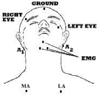 Figure 2.8 – Emplacement des ´electrodes pour l’EMG du menton. figure issue du site du Pr