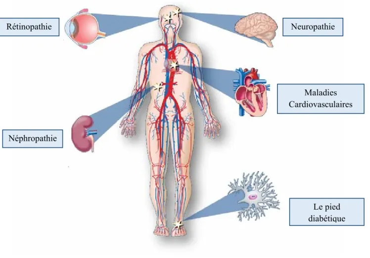 Figure I. 7 : Les complications à long terme liées au diabète. 