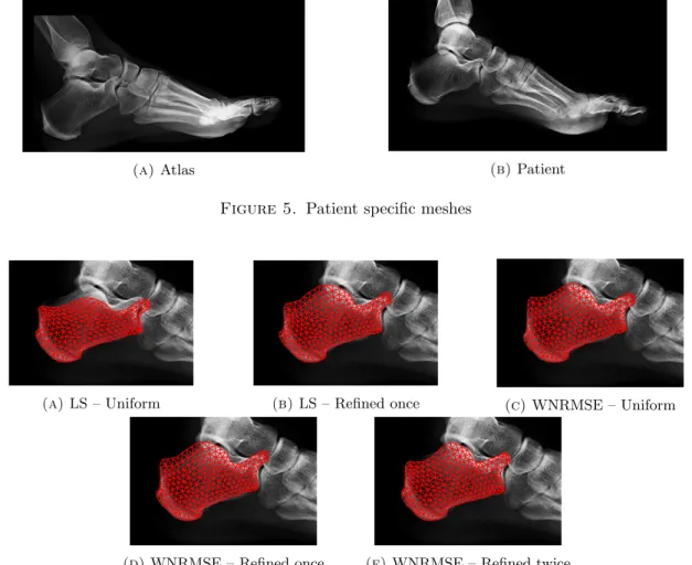 Figure 6. Patient specific meshes obtained by the different registration procedures that we tested 3.3