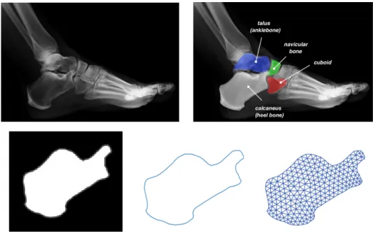 Figure 2. On top, on the left the reference (atlas) image of a foot with, on the right a classi- classi-fication of some of the bones and a description of the geometry shape of each bone considered.