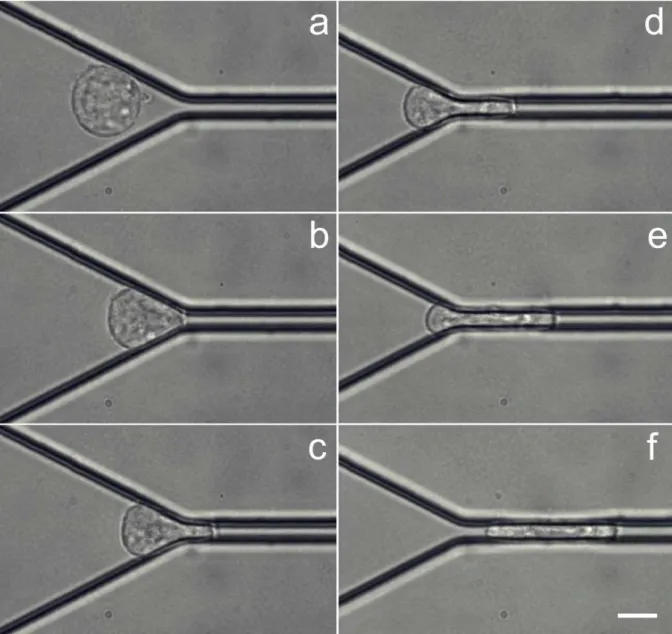 Fig. 2. Images sequence of a Blb-treated THP-1 cell during entry in the 4-µ m-wide constriction ( ∆ H = 10,8 cm  H 2 O)