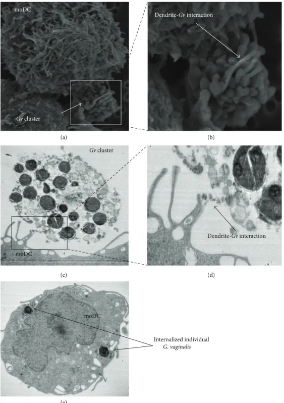 Figure 1: Pictures of DCs after exposure to G. vaginalis. (a) SEM (×5500), after a 1 h exposure, DC dendrites surrounding clusters of G.