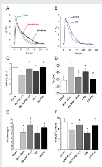 Figure 3 Ca 2+ transients and cell shortening. Ca 2+ transients in single LV cardiomyocytes field-stimulated at 1.0 Hz visualized (Fluo-4 AM), expressed as DF/F 0 in Sham, BNP-Sham, and BB-BNP-Sham mice (A) and in PMI and BB-PMI mice (B); averaged Ca 2+ tr