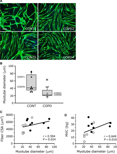 Fig. 3 Diameter of cultured healthy indi- indi-vidual and COPD myotubes. (A)  Represen-tative images of myotubes from two control cultures (CONT1, CONT6) and two COPD cultures (COPD2, COPD4) showing fluorescence double-labelling using an anti-troponin T an