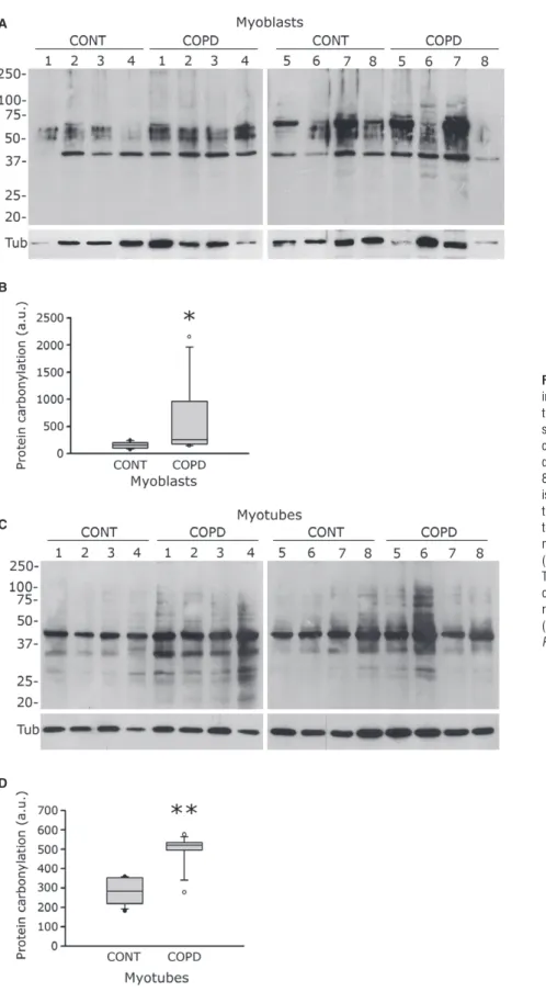 Fig. 5 Protein carbonylation in healthy individual and COPD myoblasts and  myo-tubes. Representative Western blots showing levels of protein carbonylation in cultured myoblasts (A) and myotubes (C) derived from control individuals  (CONT1-8) and COPD patie