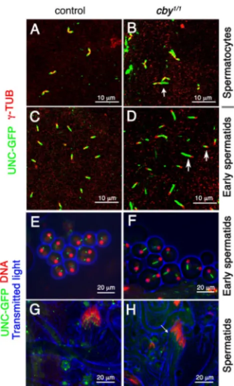 Figure 8.  UNC distribution associated with basal body function is altered  in cby 1/1  testis