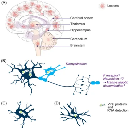 Figure 4. MeV central nervous system infection. Lesion areas are found in the brain of SSPE and MIBE  patients but the specific areas associated with RNA detection are still poorly documented (A)