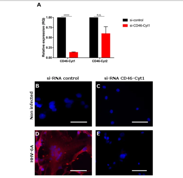 FIGURE 6 | Induction of MSRV-Env expression is dependent of CD46-Cyt1 isoforme. (A) CD46-Cyt1 and CD46-Cyt2 mRNA expression levels in