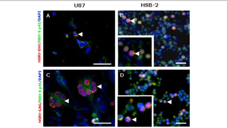 FIGURE 2 | MSRV-ENV and MSRV-GAG were expressed in HHV-6A infected cells. (A,C) U87 and (B,D) HSB-2 cells were infected with HHV-6A during 24 h