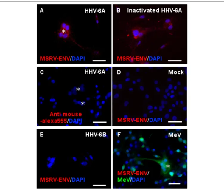 FIGURE 4 | Both infectious and UV-inactivated HHV-6A, but neither HHV-6B nor Measles virus, could induce MSRV-Env expression