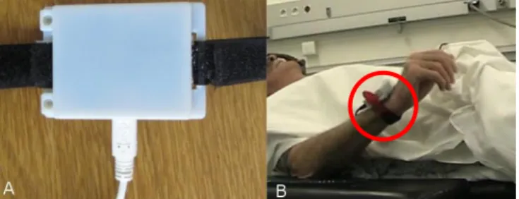 Figure 1. A) Accelerometer Case B) Accelerometer mounted to patient during surgery 