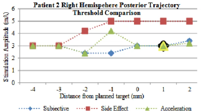 Figure 5. Comparison of thresholds for the posterior trajectory of the right hemisphere of patient 2