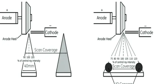 Fig. 3. Volume helical Shuttle (VHS, left) compared to wide-coverage detector axial  acquisitions (right): there is no image quality (IQ) concern with VHS, whereas with  wide-coverage detetector IQ concerns, as well as heel effect, cone beam artefact and i