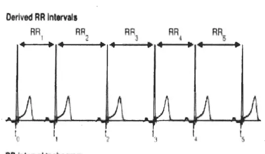 Figure 3:  Intervalle RR  no rmal retrouvé sur un électrocardi ogramme 