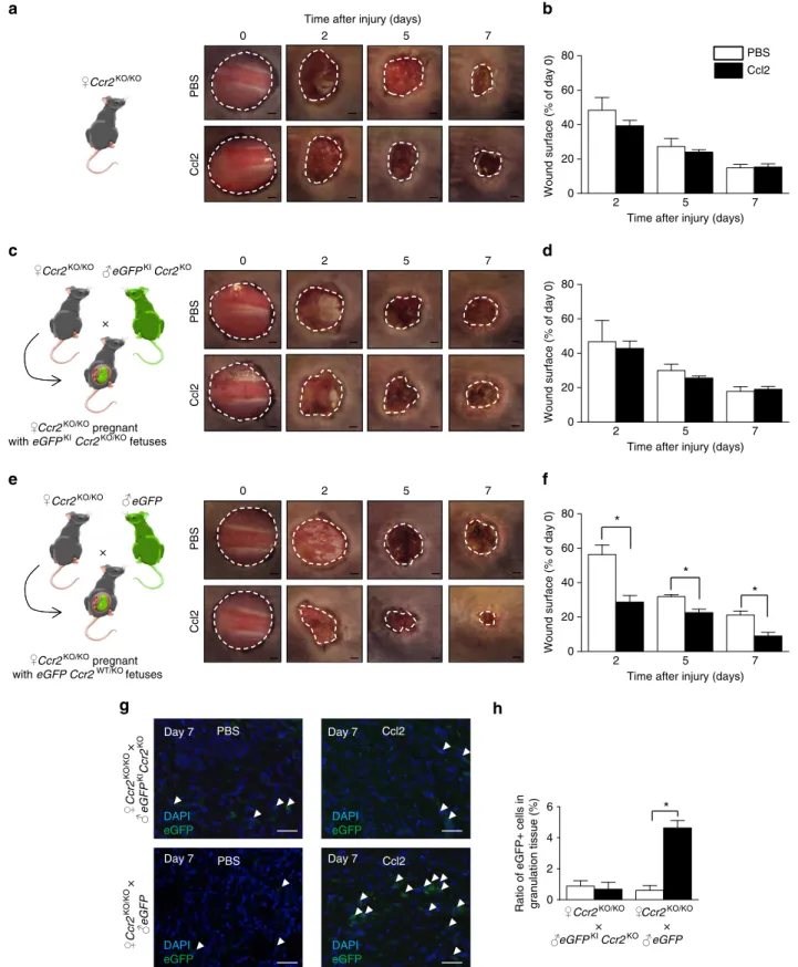 Figure 3 | FMCs are recruited to maternal wounds through Ccl2/Ccr2 pathway. An 8 mm wound was created in pregnant female mice carrying eGFP þ foetuses