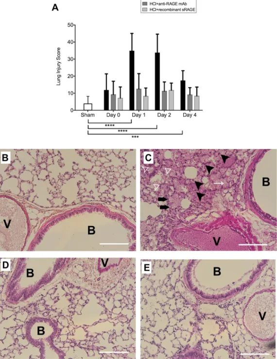 Figure 7.  Histological features of lung injury. (A) On days 1, 2 and 4, lung injury scores were higher in acid- acid-injured mice (HCl group), compared to sham controls (Sham group)(n = 4–6 for each time-point)