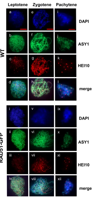 Fig 3. HEI10 foci in wild type and RAD51-GFP Pachytene. Immunolocalization of the ZMM protein HEI10 (red) and the meiotic protein ASY1 (green) in wild type Leptotene (a-d), Zygotene (e-h) and Pachytene (i-l) and RAD51-GFP Leptotene (i-iv), Zygotene (v-viii