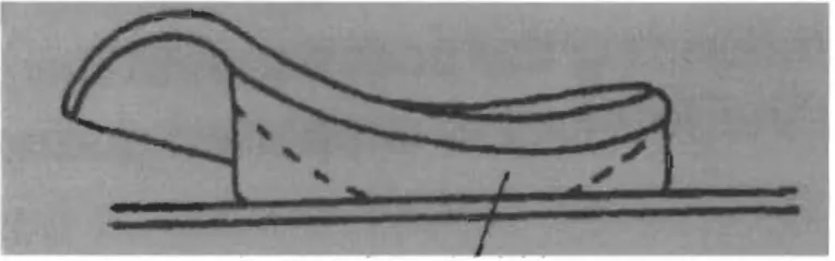 Figure 5.  Instabilité d' une orthèse plantaire avec biseau médial, tirée de  «  Human  locomotion - The  conservative management of gait-related disorders » (Michaud 20 Il)