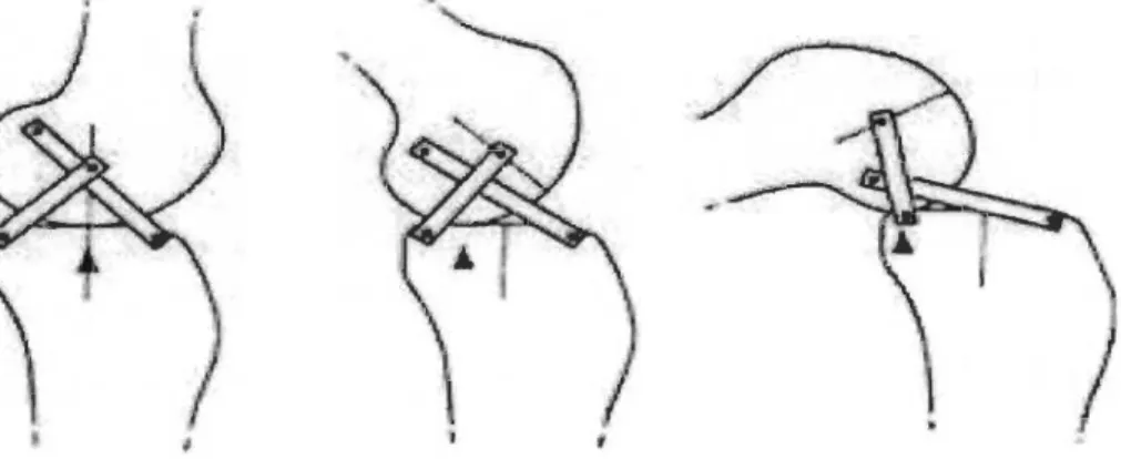 Figure 2. Centre articulaire du genou  basé sur le modèle rigide à quatre barres  Image tirée de : Hamon et coll