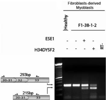 Figure 1 Dysferlin exon 32 skipping analysis. RT-PCR analysis of the transcript region flanking exon 32 (exons 30–33) in control  fibroblasts-derived myoblasts and fibroblasts-fibroblasts-derived myoblasts from patient F1-38-1-2.