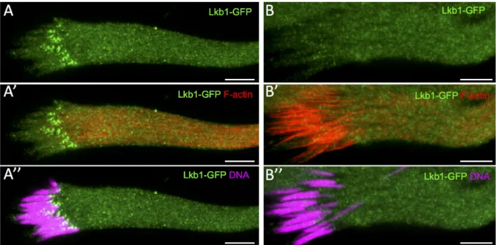Fig 5. LKB1 accumulates at the front side of the WT spermatid nuclei before actin cones become detectable