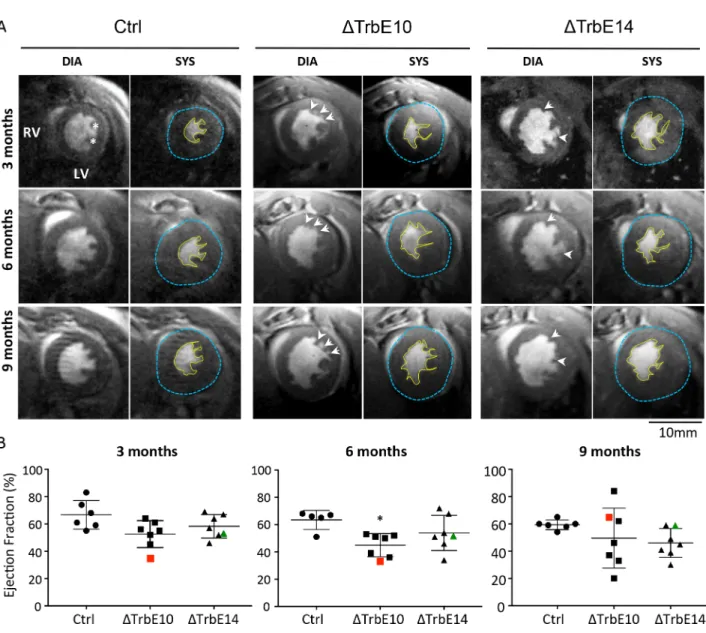Fig 5. Longitudinal study of cardiac function by magnetic resonance imaging in Nkx2-5 conditional mutant mice