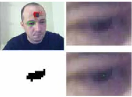 Figure 8 shows some images obtained in a real-time gaze detection experiment. The 3D gaze vectors are superimposed on the tracking result, the low-right image represent a degenerated case