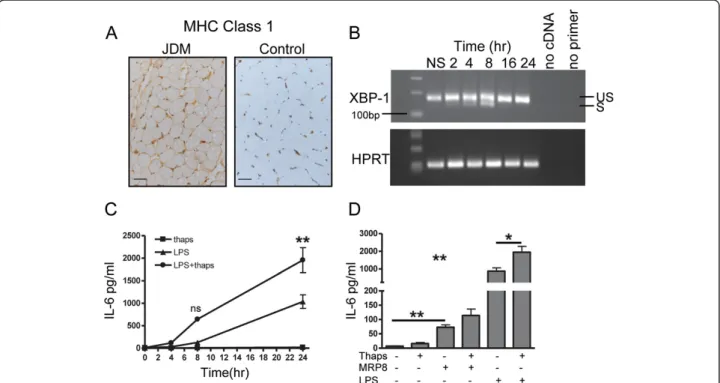 Figure 4 Effect of MRP8 stimulation in combination with ER stress on IL-6 production by muscle cells