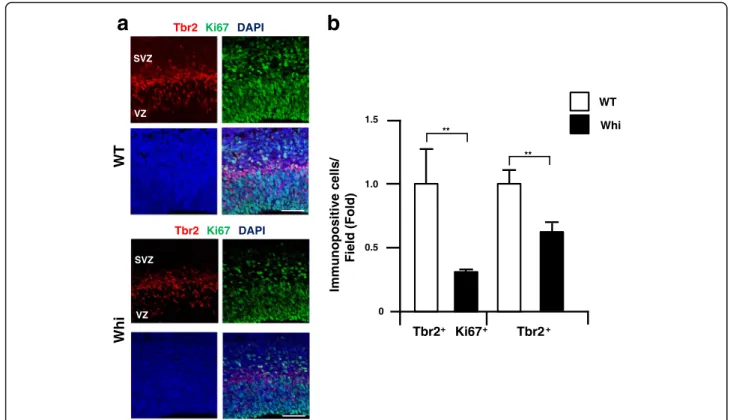 Fig. 5 Decrease of Tbr2-positive cells in Chd7 mutant mouse in the developing cerebral cortex