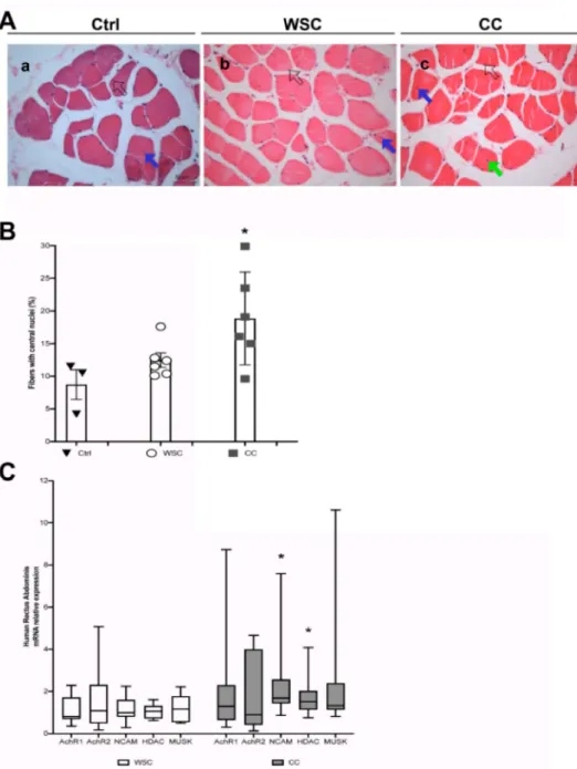Figure 4. An increased number of central nuclei in the human Rectus Abdominis fibers is associated with cachexia and denervation markers