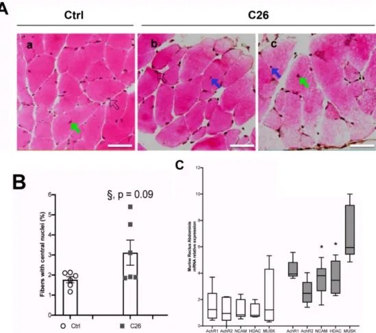 Figure 3. An increased number of central nuclei in the murine Rectus Abdominis (RA) fibers is associated with cachexia and denervation markers