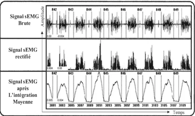 Figure 2.10  Illustration d'un signal sEMG diaphragmatique brut rectifié  et intégré; 