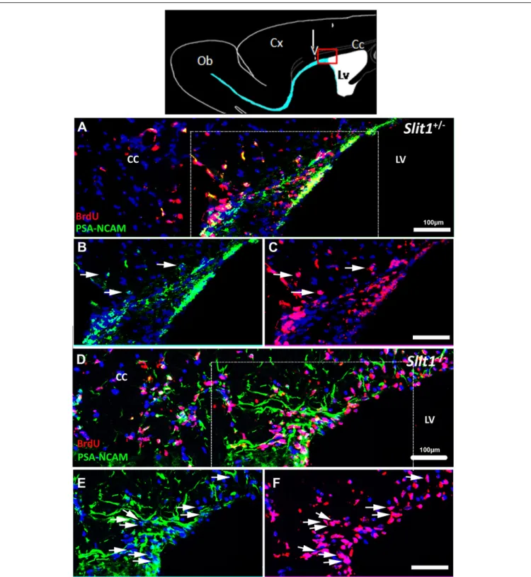 FIGURE 4 | Dispersal of SVZ-derived progenitors into the corpus callosum in response to LPC- induced demyelination of the CC