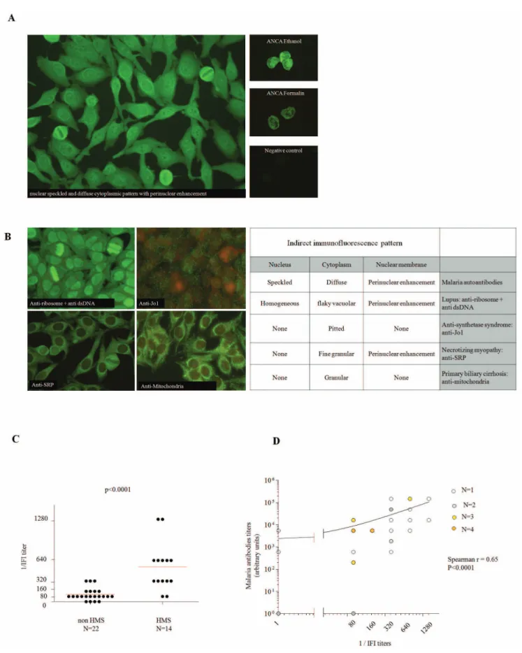 Figure 1. Distinct immunofluorescence pattern on HEp-2000 TM cells detected in the serum of patients with malaria