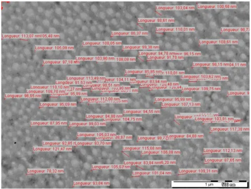 Figure 1. Example of longitudinal diameter measurement (cryopreserved sample diameter estimated on a picture at 40,0003  magnification)