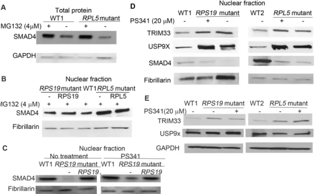 Fig 5. Rapid proteasome degradation of SMAD4 in DBA iPSCs. DBA iPSCs, and the corrected DBA cells were cultured in the iPSC medium, and treated with proteasome inhibitors MG132 (4 μ M) for 12h or PS341 (20 μ M) for 4h