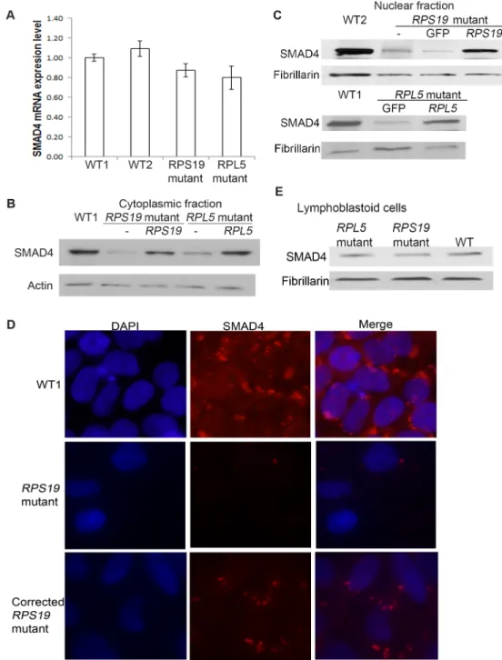 Fig 1. Significant decrease of SMAD4 protein in DBA iPSCs. DBA iPSCs (labelled as “RPS19/RPL5 mutant ” or “RPS19/RPL5 mutant- ” ), the corrected DBA cells (expressing a WT version of the mutated gene, RPL5 or RPS19 , labelled as “RPS19/RPL5 mutant RPS19/RP