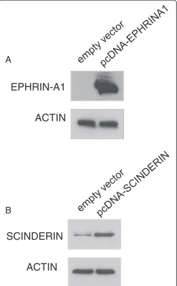 Figure 1 Western-blot analysis of anti-EPHRIN-A1 and anti-SCINDERIN antibody specificity