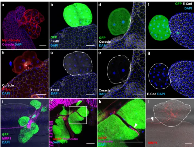 Fig. 3 Oncogene expression induces epithelial tumourigenesis in the accessory gland. a – l GFP-Ras V12 expressing clones display hallmarks of cancer.