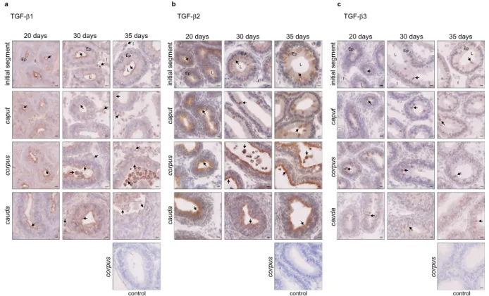 Figure 5.  Localisation of the TGF- β  isoforms in young mice. Localisation of the TGF- β  isoforms in the  initial segment, caput, corpus, and cauda epididymides of young mice, aged from 20 days to 35 days