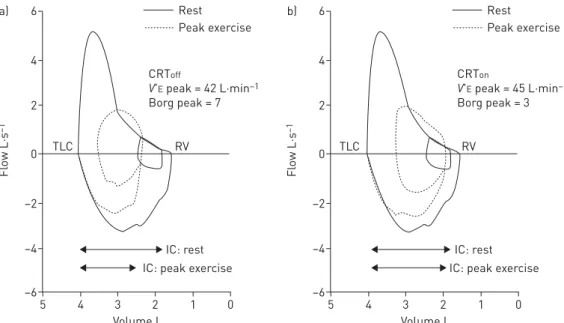 FIGURE 4 Changes in operating lung volumes expressed as % of predicted total lung capacity (%TLC predicted) are shown as minute ventilation ( V′ E ) increases during symptom-limited incremental cycle exercise in patients with chronic heart failure followin