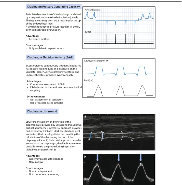 Fig. 1 Techniques to investigate diaphragm function in the ICU