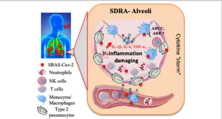 FIGURE 1 | Proposed host immune responses during SARS-CoV-2 infection. Aerosolized uptake of SARS CoV-2 leads to infection of ACE2-expressing target cells, such as alveolar type 2 pneumocytes or other unknown target cells