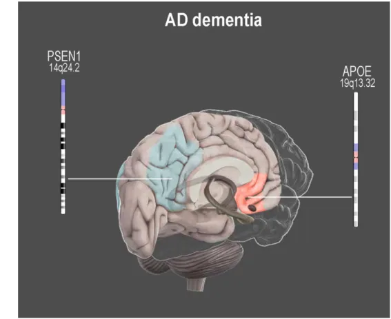 Figure 3 Main effects of genetic risk factors for AD on brain functional connectivity in AD  dementia individuals 
